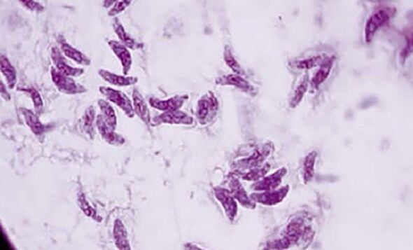 նախակենդանու մակաբույծ toxoplasma gondii տոքսոպլազմոզի հարուցիչը